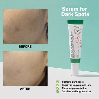 AXIS-Y Dark Spot Correcting Glow Serum 50ml / 1.69 fl. oz | Brightening Serum | Korean Skincare, Dark Spot Treatment, Hyperpigmentation Treatment